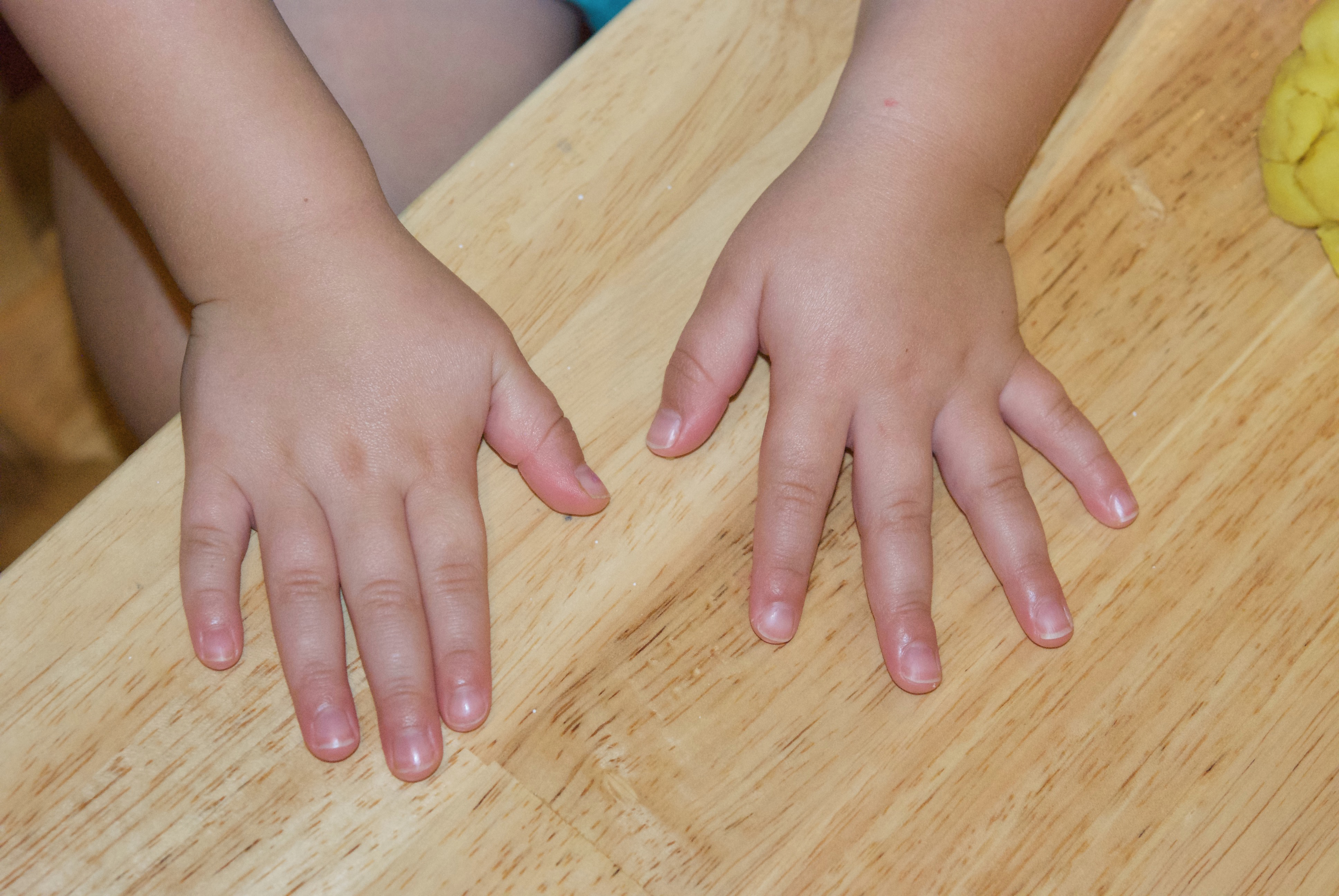 Пальцы становятся толще. Ногти для детей. Детские пальцы рук.